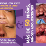 5 jornada labio