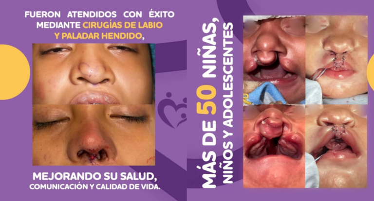 5 jornada labio